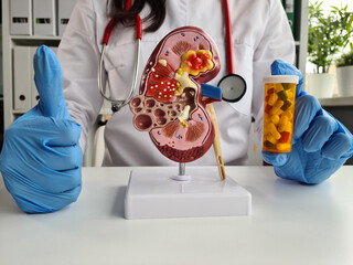 Doctor shows model of kidney and pills - obrazy, fototapety, plakaty