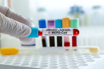 Doctor holding tube of blood sampleidentified with Positive to MERS-CoV or Camel virus in the laboratory. Technican testing blood sample with presence positive to MERS-CoV virus