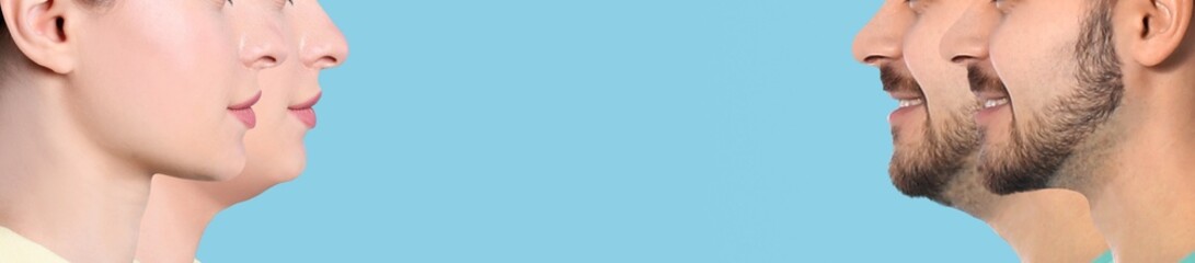 Double chin problem. Collage with photos of people before and after plastic surgery procedure on light blue background, banner design. Space for text