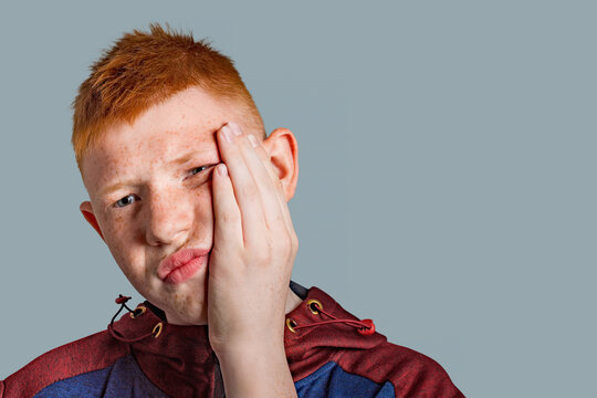 A teenage boy with red hair suffers from a toothache.