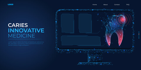 Digital 3d low poly model of dental caries. Dental treatment and restoration concept. Abstract background vector illustration.