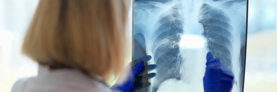 Doctor looks at x-ray in hospital. Medical specialist in radiology and medical sciences studies diseases
