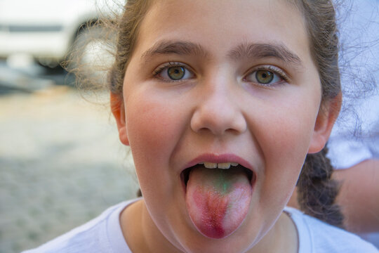 A teenage girl ate a candy and shows a colored tongue. The concept of food coloring in children's sweets, artificial food coloring, natural coloring, food coloring allergy.