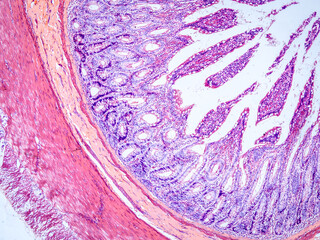 small intestine cross section under the microscope - optical microscope x100 magnification