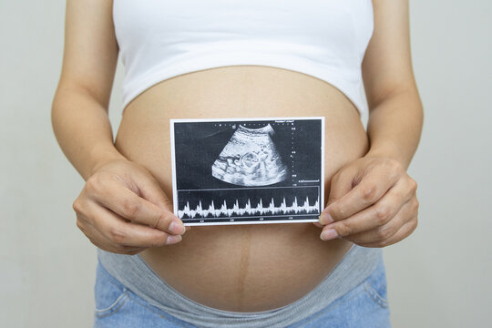Close up pregnant woman holding ultrasound image. Concept of pregnancy, Asian Young mother waiting of the baby.