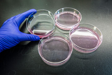 Cell Culture or Tissue culture