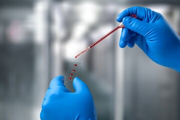 Hand holds a micropipette in modern laboratory