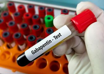 Blood sample for Gabapentin test.  Set therapeutic dose. Epilepsy, seizures.