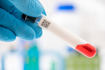 Test tube with blood sample for biochemical analysis in medical laboratory