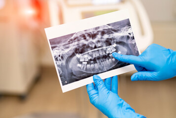 Hospital orthodontic treatment. Teeth dental examination.
