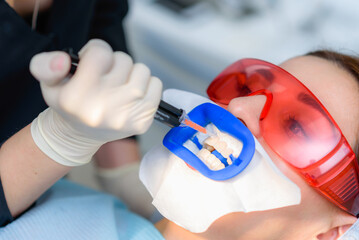Preparing the oral cavity for whitening with an ultraviolet lamp. Close-up