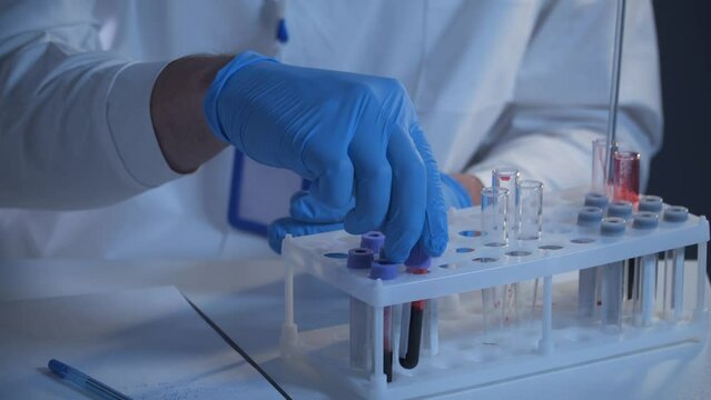 Pathologist working in lab with blood samples. Scientist processing DNA sample in laboratory. Healthcare, blood examination, research of blood. Laboratory worker preparing slide with blood samples. 
