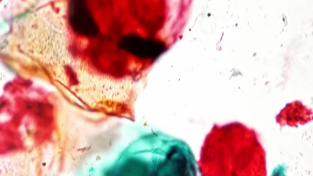 Macro footage of rotifera whole mount under laboratory microscope 400x against bright field background. Closeup of planktons called wheel animals enlarged for detailed research. Learning aqua organism