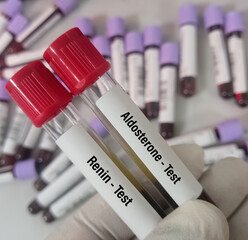 Blood samples for Aldosterone and Renin test.