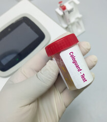 Stool sample for Fecal Cologuard test to diagnosis of colon and rectum cancer.