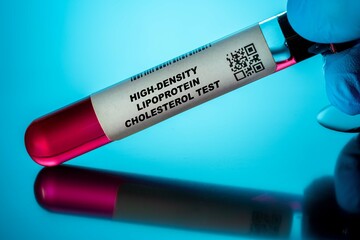 High-Density Lipoprotein Cholesterol Test Blood Tests for Older Adults. Recommended Blood Test for...