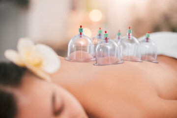 Cupping therapy, spa and zen woman for chinese alternative medicine treatment for back pain and...