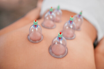 Spa, healthy body and cupping therapy for stress, pain treatment or wellness. Luxury, cup suction...