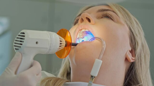 the hands of the dentist polymerize the filling in the client's mouth with a special lamp. dental treatment