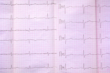 sheet of pink millimeter paper with diagram of a medical examination of the heart on an electrocardiogram