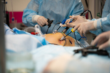 Close up ands of surgeons during operation with surgical laparoscopy instruments