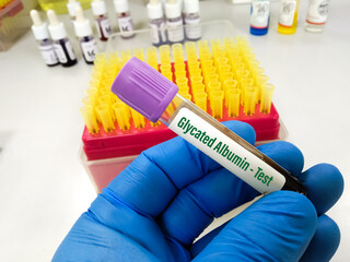 Canine Distemper Virus Ag Test positive blood sample. Qualitatively detects Canine Distemper Virus...