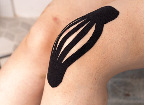 Glue the black kinesiology tape on the leg. Placing kinesio tape on patient's. The fight against bruises, thanks to teips. Stick a tape in the form of a "flashlight", resorption of the bruise