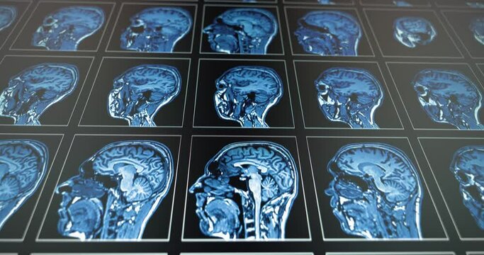 Several medical scans showing in motion
