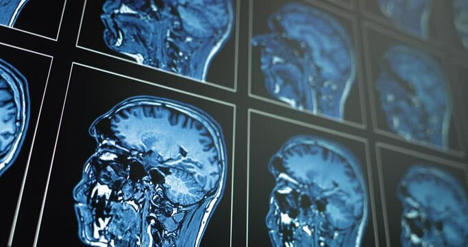Several medical scans showing in motion