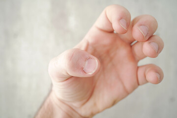 Cut the nails on the hands with nail clippers. Men's manicure. Male hand close up.