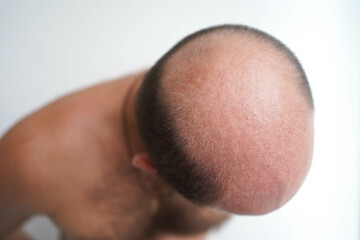 bald head of an adult man of European appearance on a light gray background