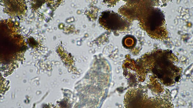 human parasite. gut intestinal infection disease. microorganism infection in hospital 