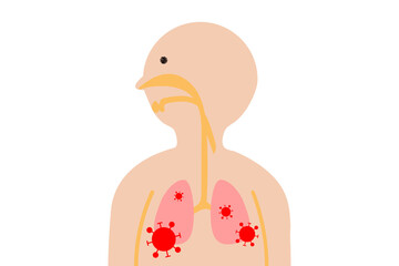 肺炎のイラスト(png)