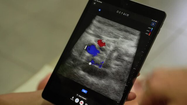 Computer diagnostics with a portable X-ray of a person. The result of the ultrasound on the screen of the tablet is shown by doctors with a hand