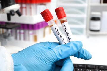 Blood samples for testing vitamin in the laboratory