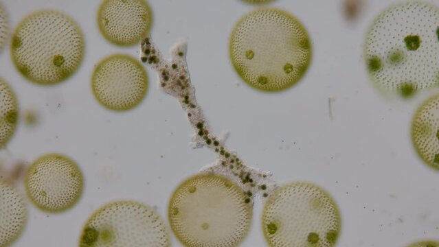 Mikroskop Film von einer kriechenden Am&ouml;be, umgeben von der Alge Volvox, mehrere szenen mit unterschiedlicher Vergr&ouml;&szlig;erung, 50 fps