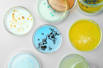 Petri dishes with different bacteria colonies on white background, flat lay
