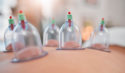 Cupping therapy, asian physiotherapy and massage spa for zen spiritual health healing, person with back pain and stress relief. Alternative detox, luxury medicine and muscle wellness with hot glass