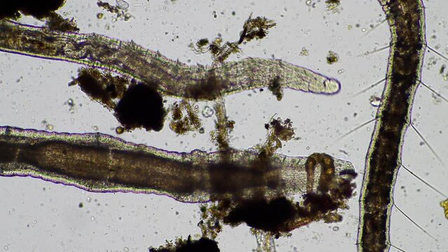 human parasite. gut intestinal infection disease. microorganism infection in hospital 