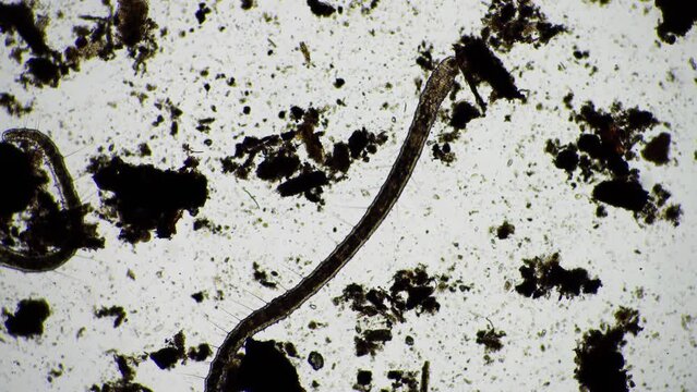 human parasite. gut intestinal infection disease. microorganism infection in hospital 