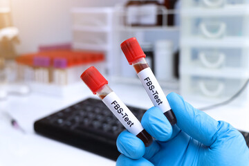 FBS test to look for abnormalities from blood