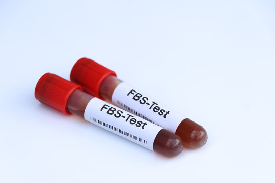 FBS test to look for abnormalities from blood