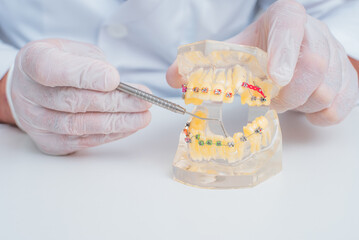 doctor orthodontist shows how the system of braces on teeth is arranged