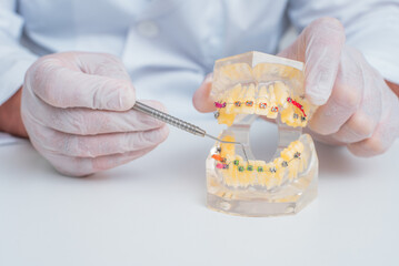 doctor orthodontist shows how the system of braces on teeth is arranged