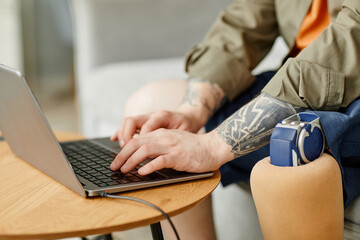 Closeup of man with prosthetic leg using laptop while working, copy space