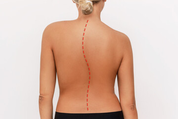 A young tanned woman with a crooked spine isolated on a white background. Incorrect spine position....