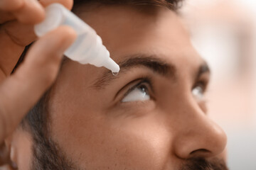 Handsome man using eye drops, closeup