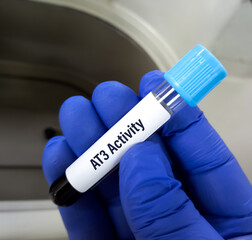 Blood sample for AT3(Antithrombin III) activity test. diagnosis for clotting disorder. Functional Antithrombin III, AT III, AT 3