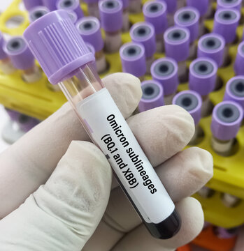 Blood sample for Omicron sublineages(BQ.1 and XBB) test, COVID-19 coronavirus.