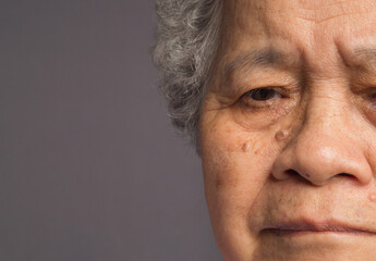 Half face of an elderly Asian woman against a gray background